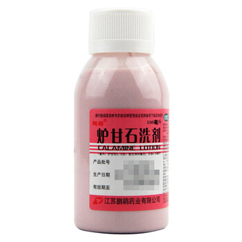 鹏鹞炉甘石洗剂100ml用于急性瘙痒性皮肤病药品湿疹痱子外用药洗液
