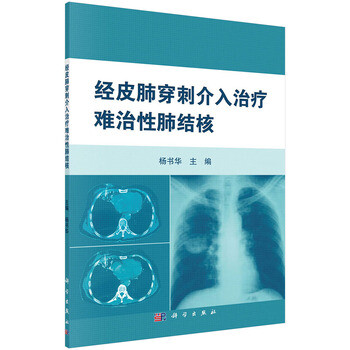 《经皮肺穿刺介入治疗难治性肺结核》【摘要