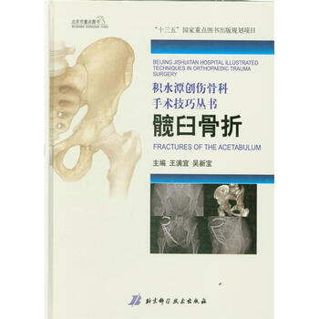《髋臼骨折-积水潭创伤骨科手术技巧丛书》