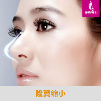 广州天姿 缩小鼻翼 隆鼻雕刻鼻部比例,鼻翼缩小