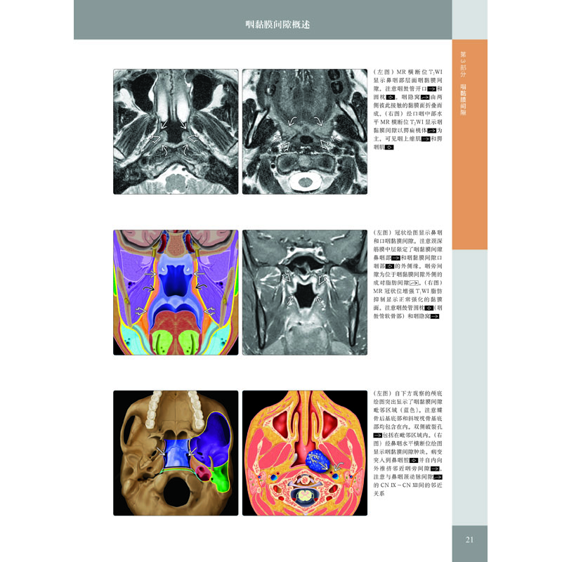 头颈部影像诊断学（原著第3版）