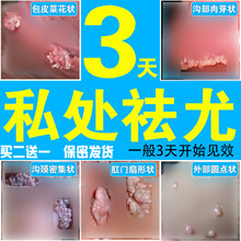 私处肛门湿疣检测防复发扁平疣去疣液hpv组合装非中药品生殖器珍珠疹