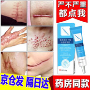疤克巴克祛疤膏去疤痕藥l膏疤痕修復(fù)除l疤膏去祛疤痕專用修復(fù)質(zhì)酸透明硅凝膠兒童臉部剖腹產(chǎn)手術(shù)醫(yī)用硅酮貼 【新老疤皆可用】成人兒童燙傷疤痕增生凸起去除l疙瘩