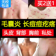 麟醫(yī)生【背后和胸口長痘痘背上】頭上毛囊炎膏背部前胸后背胸前長紅疙瘩 身上頭部馬拉色菌去祛熱凝膠*1盒