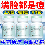 臉上去痘痘的藥 內(nèi)分泌失調(diào)男長痘中藥內(nèi)調(diào)祛痘藥口服青春痘姨媽痘熬夜痘上火痘祛痘內(nèi)服藥復(fù)方珍珠暗瘡片 5盒裝【臉上下巴紅腫硬痘痘內(nèi)服藥】