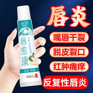 老中醫(yī)唇炎嘴唇干裂脫皮起皮修護(hù)潤唇膏唇周口角紅癢保濕中藥護(hù)理唇愈膏 一盒裝