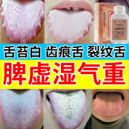 脾胃虛弱疏肝健脾丸 金不換健脾丸健脾祛濕調(diào)理脾胃肝郁脾虛濕氣重去濕氣齒痕舌苔白厚成人兒童中藥 2盒裝【健脾祛濕中藥調(diào)理裝】