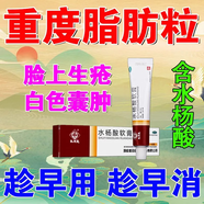 脂肪粒去除藥膏 用于眼部脂肪粒油脂粒眼睛周圍有白色顆粒脂肪粒面部脂肪粒不用手?jǐn)D不傷肌膚 水楊酸軟膏 5支【脂肪粒不用擠】