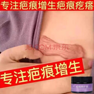 京勝疤痕膏摔傷抓傷疤體質(zhì)增生凸硬肉疤痕疙瘩胸前修復(fù)去除手術(shù)疤專 買3+2【五盒鞏固裝】