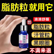 脂肪粒非去除神器眼部專(zhuān)用白脂肪粒眼霜脂肪?？诵呛构芰鲇椭＞A液膏眼周白色顆粒 買(mǎi)2送1 三盒只要2盒錢(qián)
