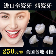 全瓷牙冠威蘭德二氧化鋯愛爾創(chuàng)澤康3m拉瓦全瓷牙根管治療鑲牙補(bǔ)牙義齒假牙齒貼面片全瓷牙套二氧化鋯烤瓷牙 3m拉瓦全瓷牙