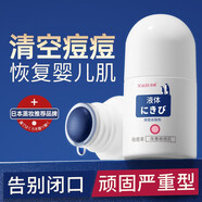 熙雅（SCaUER）祛痘精i華液淡化痘印修復祛痘膏改善痘痘肌修護祛閉口青 潔i面乳* 潔面乳*3