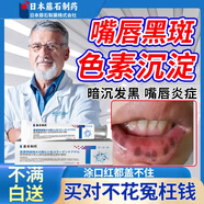 藤石制藥嘴唇黑色素搭去除烏唇膏嘴角黑色素沉淀唇周暗暗沉淡化男士女生XT 買3送2  鞏固裝【多年嘴唇黑、黑的時(shí)間久】送棉簽