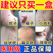 維A酸乳膏 治扁平疣用藥膏面部脖子 去瘊子肉粒疙瘩 除小肉粒猴子痤瘡絲狀疣跖疣雞眼祛疣膏 皮膚用藥 【國藥】2支