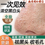 同仁堂清潔泥膜祛黑頭泥膜清潔毛孔收縮毛孔去粉刺閉口深層清潔男女通用 【收縮毛孔祛黑頭】清潔泥膜