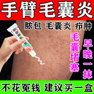 手臂毛囊炎專(zhuān)用藥膏 手臂毛囊炎長(zhǎng)痘痘胳膊上的小疙瘩毛囊堵塞用什么特新效期藥 皮膚用藥 莫匹羅星軟膏 5盒裝【長(zhǎng)期手臂毛囊炎】告別毛囊炎