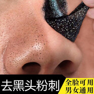 韓泊莉酵素撕拉面膜去黑頭粉刺收縮毛孔細(xì)致毛孔祛黑頭深層清潔提亮膚色 3瓶裝【贈(zèng)旅行管裝*3支】