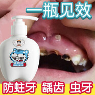 醫(yī)后兒童牙膏3-12歲含氟換牙期防蛀牙蟲牙兒童專用牙膏200g 3支裝【只需2支價(jià)】86%媽媽選擇