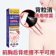 艾小凡美背抑菌噴霧背部不平疙瘩痘背部紅點(diǎn)痘抑菌背粒消男女通用噴霧 60ml 1瓶 【買(mǎi)二餸一】