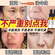 阿琪思淚溝填充神器去除太陽穴面部凹陷填充豐臉部凹陷針法令紋填充針劑 面部豐盈精華液