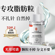 同仁堂（TRT）脂肪粒去除神器眼部專(zhuān)用去眼部脂肪粒眼袋清肌顆粒眼部精華液30ml