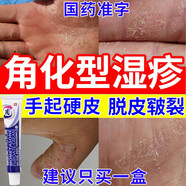 手部角化型換季過敏用藥手指手掌皮膚瘙癢干燥粗糙硬塊真菌感染角化皸裂性皮膚干燥起皮止癢藥糠酸莫米松乳膏 一盒【皮膚開裂】
