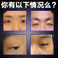 大眼精華液眼睛變大開眼角神器自然擴(kuò)眼精油單眼皮變雙眼皮精華油 #1#