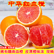 正宗贛南臍橙江西贛州中華名果紅血橙新鮮橙子團購送禮整箱現摘 帶箱20斤 果徑75-80