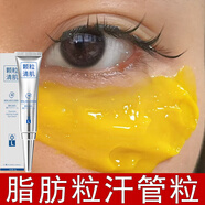 L0顆粒清肌眼霜祛脂肪粒眼部去除神器汗管粒油脂粒克星淡化黑眼圈 店長推薦【療程裝】*3支