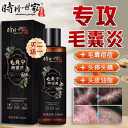 官方直售李時(shí)珍世家毛炎寧洗發(fā)水夫密碼液去屑止癢毛囊洗發(fā)水 一瓶體驗裝150ml/瓶