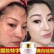 冰菊（Bing Ju）冰菊適合中年媽媽用的面霜補(bǔ)水保濕中老年婦女擦臉 女擦臉抹油