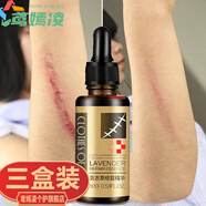 薰衣草精油去疤痕修復(fù)精油去痘印妊辰紋專用 3瓶裝