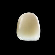 DALEK 戴立克二氧化鋯全瓷牙烤瓷牙套牙冠牙齒假牙美白牙齒 3M蛀牙補(bǔ)牙超聲波洗牙潔牙全瓷超薄貼面 全瓷貼面