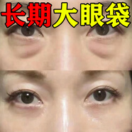 眼袋貼可搭去大眼袋嚴重中老年專用產(chǎn)品用皺紋細紋黑眼圈男士女士 一盒裝