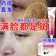 維a酸乳膏去老年斑專用藥搭祛斑膠囊祛斑i霜老年斑專用(發(fā)貨特效)一皮夜消除老年黑斑臉部手背黃褐斑雀斑曬斑 5乳膏【滿臉都是斑 不敢出門】