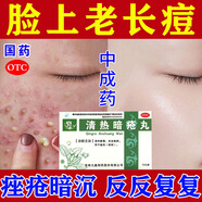 治痤瘡痘痘的藥 解毒痤瘡清熱暗瘡?fù)?清熱解毒祛痘痘粉刺和痘印 男女學(xué)生成人臉上反復(fù)長痘痘青春痘的藥 3盒【去痘痘和痘印】