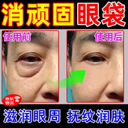眼袋去除神器男士去眼袋眼霜中老年祛嚴(yán)重黑眼圈去皺紋提拉緊致 一瓶裝【體驗(yàn)裝】