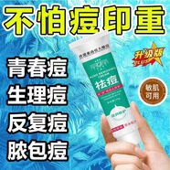 香港東南亞藥房祛痘膏淡化痘印痘坑修復(fù)改善粉刺閉口去痘痘和痘印 五盒強效裝 香港東南亞草本祛痘膏20g一盒