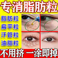 萊覽奧蓋脂肪粒去除藥膏汗管瘤油脂粒眼睛下面脂肪粒去除神器眼部藥專用膏 買3送2【重癥脂肪瘤臉黃瘤患者】