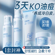儒意B5男士水乳套裝補水保濕提亮膚色控油祛痘淡化痘印青少年護膚品 【搞定突發(fā)痘】B5水乳套裝