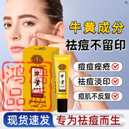 百草堂牛黃祛痘膏學(xué)生青春痘淡化痘印體培牛黃改善面部痘斑痘坑修復(fù)痘疤 1盒30g 體驗裝