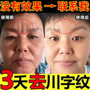 絲幕川字紋去除神器去法令紋去抬頭紋男士去皺紋抗衰老緊致嘴角八字紋 男女通用【1盒】