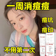 她悠凹洞性痘印學(xué)生男女痘膏臉部青春痘粉刺淡化黑紅凹性痘印 5盒療程 5盒療程-熬夜上火臉上起痘祛痘印