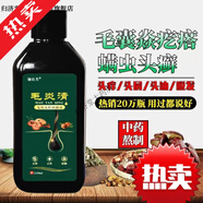 鈹藥師毛炎寧毛炎清洗發(fā)水專用頭皮毛囊焱炎發(fā)用皮膚液蟲去屑 一瓶體驗(yàn)裝頭油頭癢 210ml