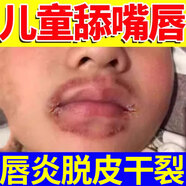 械の源防止小孩咬下嘴唇神器苦瓜水咬嘴唇矯正寶寶嬰兒壞習(xí)慣 套裝【1盒苦瓜膏+1盒唇膏】防細(xì)菌感染唇炎