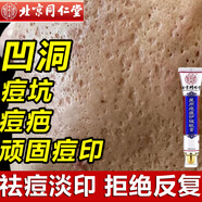 同仁堂祛痘印修復(fù)淡化痘印痘坑修復(fù)凹洞去痘坑去痘疤去痘痘和痘印粉刺 一盒裝【拍二發(fā)三】