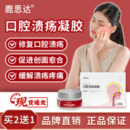 鹿思達口腔潰瘍凝膠緩解口腔潰瘍疼痛修復及促進(jìn)潰瘍創(chuàng  )面愈合口腔修復液 2盒裝【修復促愈潰瘍】