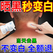 黛蘭卡曬黑了修復(fù)快速變白男女士兒童皮膚曬黑曬傷手臂臉部脖子美白神器 油性混合性肌膚 三盒【修復(fù)去黑