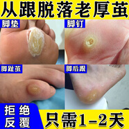 去老繭的特藥效去腳底老繭去硬皮腳墊軟化根雞眼去肉刺無痛脫落hpv專用藥去疣藥皮膚用藥水楊酸軟膏 一盒裝【軟化角質 去死皮】早用早好