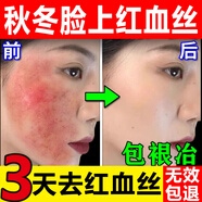 去紅血絲修復角質(zhì)層薄敏感肌修復屏障受損秋冬季節臉部敏感肌膚霜 舒緩修護霜*1盒裝